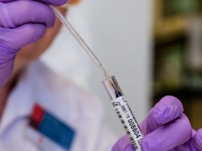 Итальянские ученые: переболевшие коронавирусом не заразны даже при положительном тесте